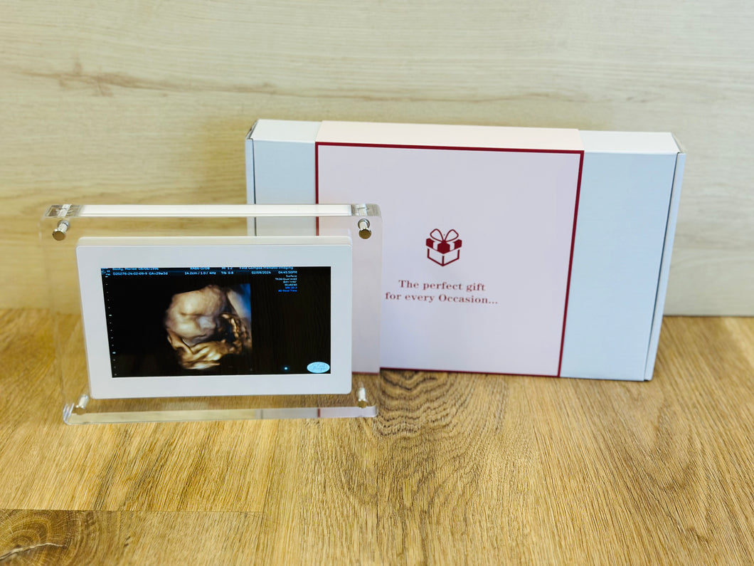 Acrylic Digital Picture Frame (With Motion Video!)
