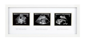 Trimester Frame