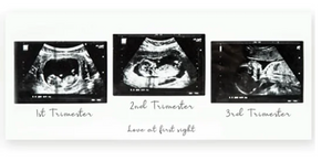 Three Trimester Frame